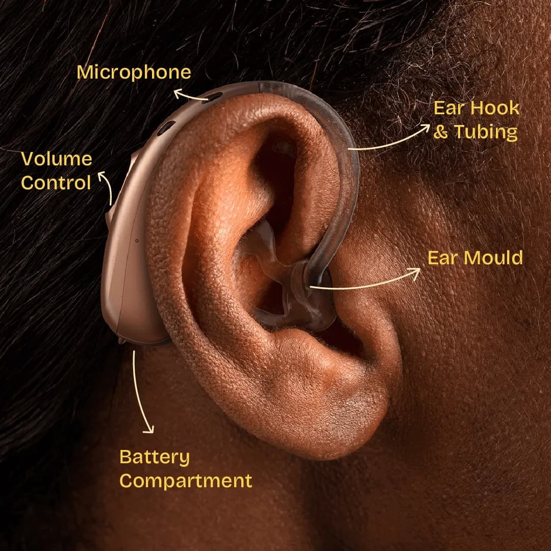 Behind the ear machine cosmetic view - a person wearing it on the ear with ear mould. Components shown with arrows