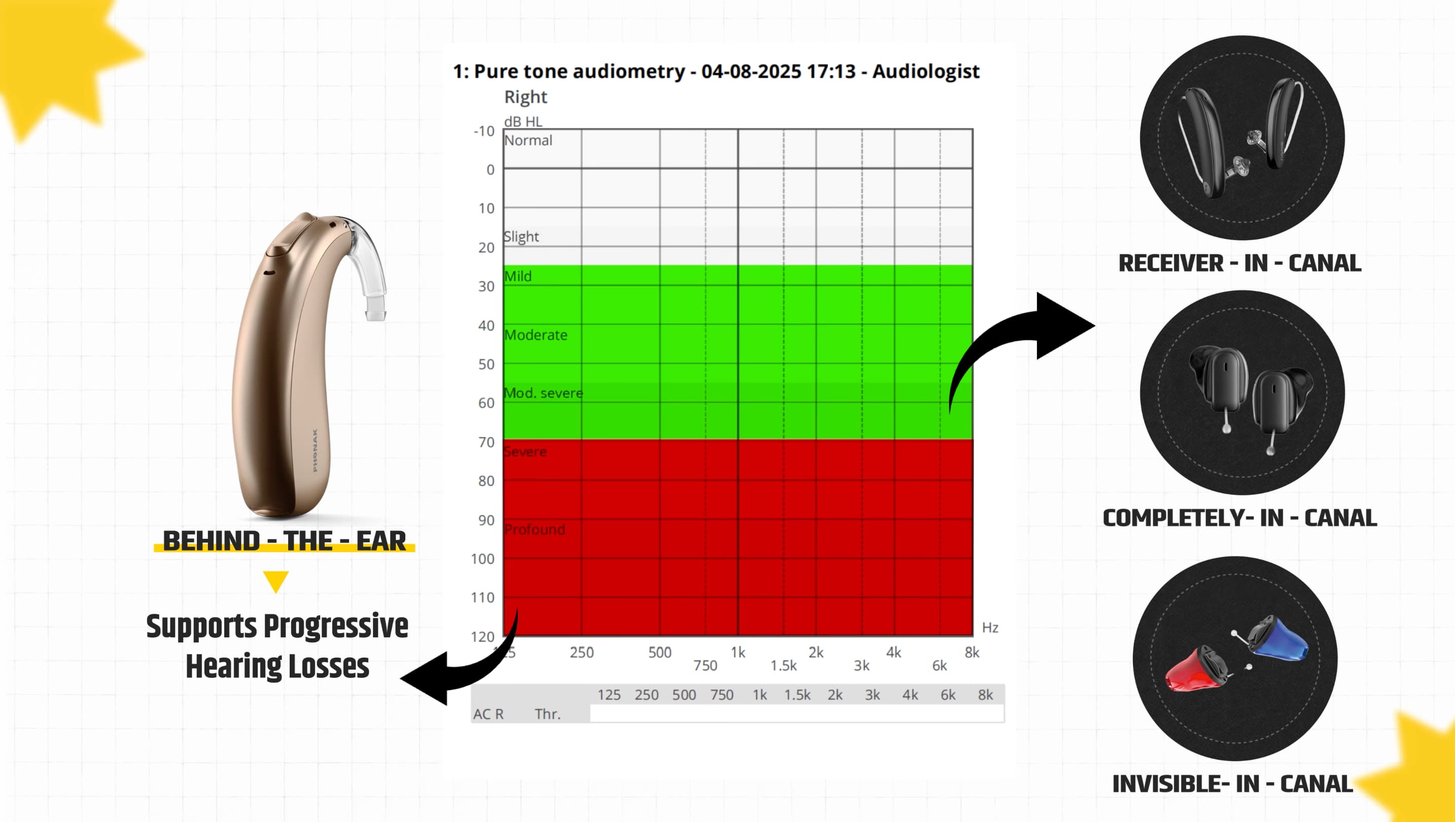 Behind the ear decision making rule of thumb