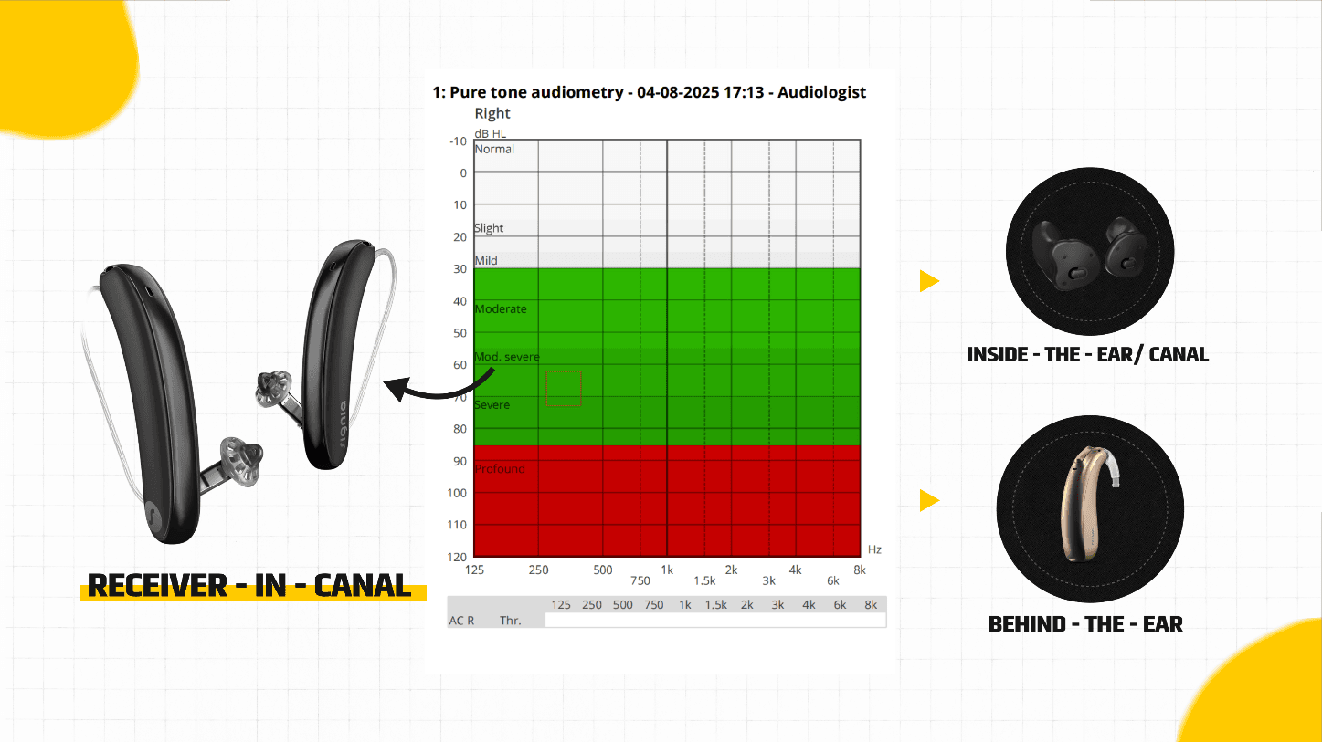 Receiver in the canal ear decision making rule of thumb