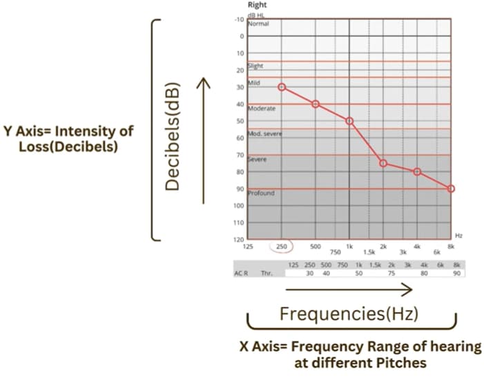 This is an Audiogram. It is used to indicate the level of hearing a person has. It has the loudness depicted in decibles on the y-axis and the pitch/frequency on the x-axis.